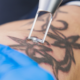 Revolutionizing Aesthetic Appeal: The Future of Tattoo Removal, Skin Rejuvenation through LED Therapy, and Art of Lip Enhancement